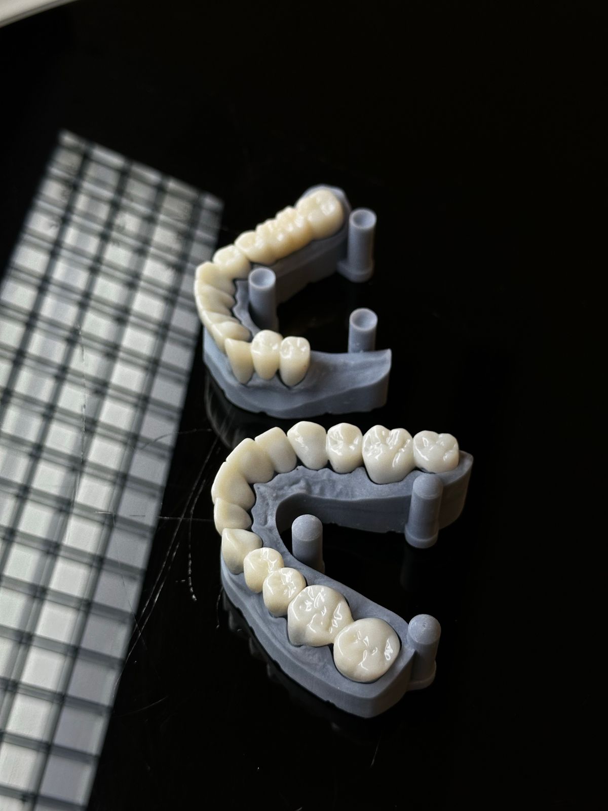 Illustrative digital dental model showing restorative implant placement, not the actual clinic